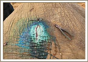 Mulika's wound after treatment